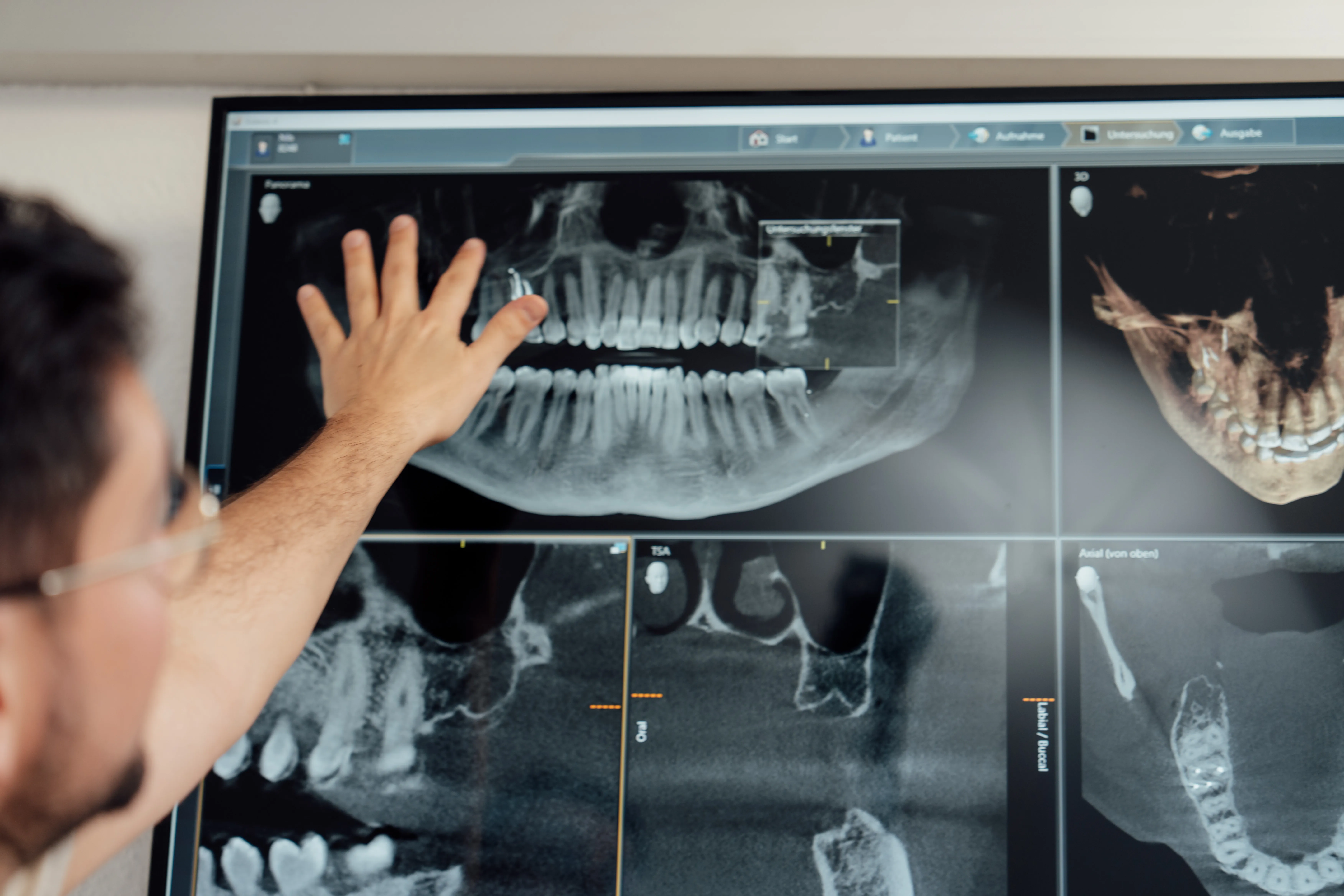 Natural dental materials