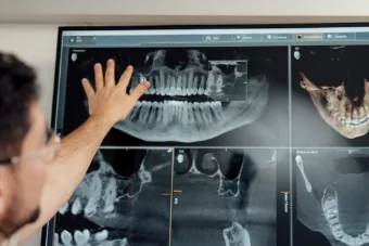A 3D / CBCT jaw scan reviewed on screen to reveal hidden inflammation