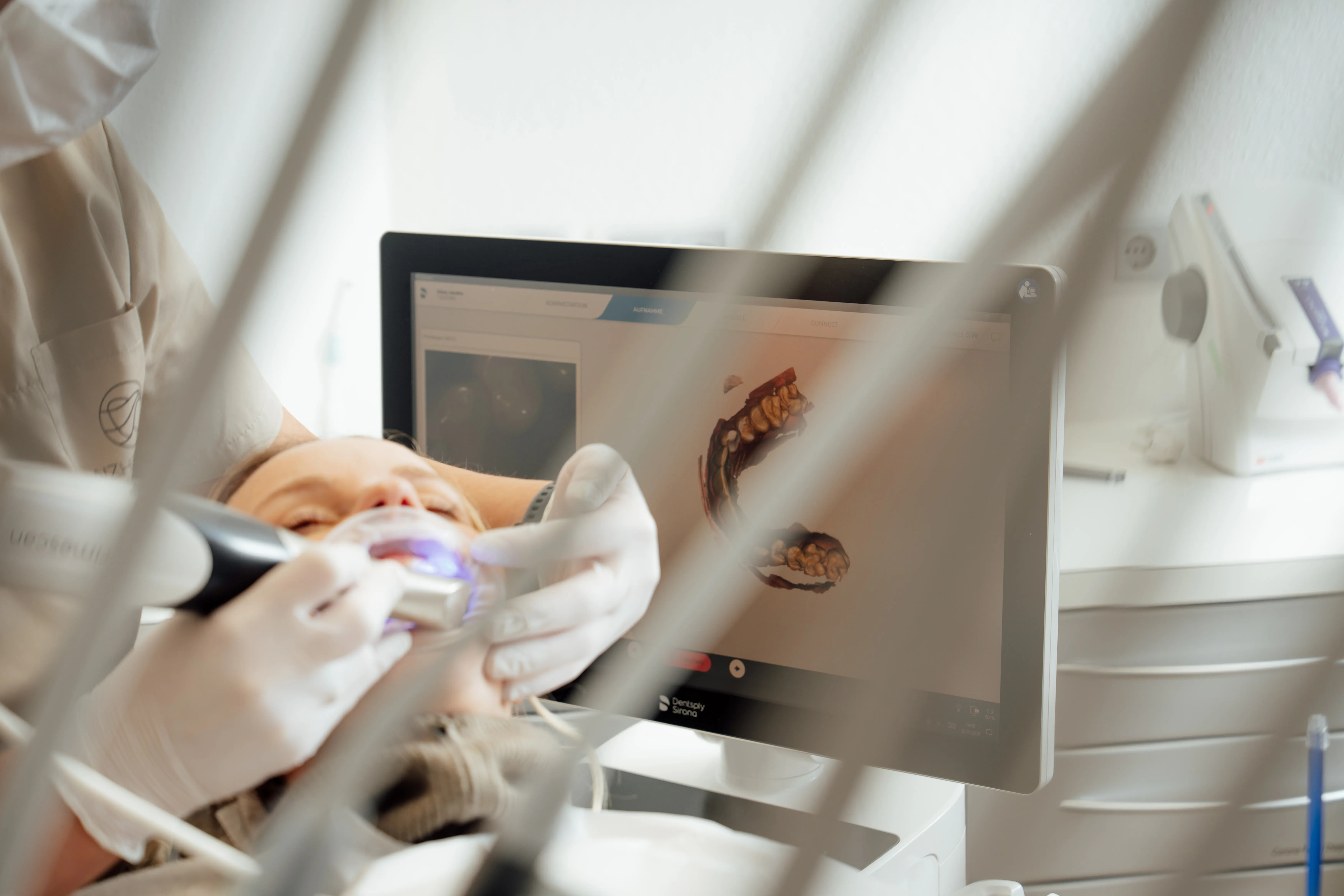 Biocompatible dental veneers